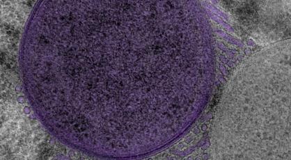 Image en microscopie d'une cellule bactérienne entourée de son réseau membranaire